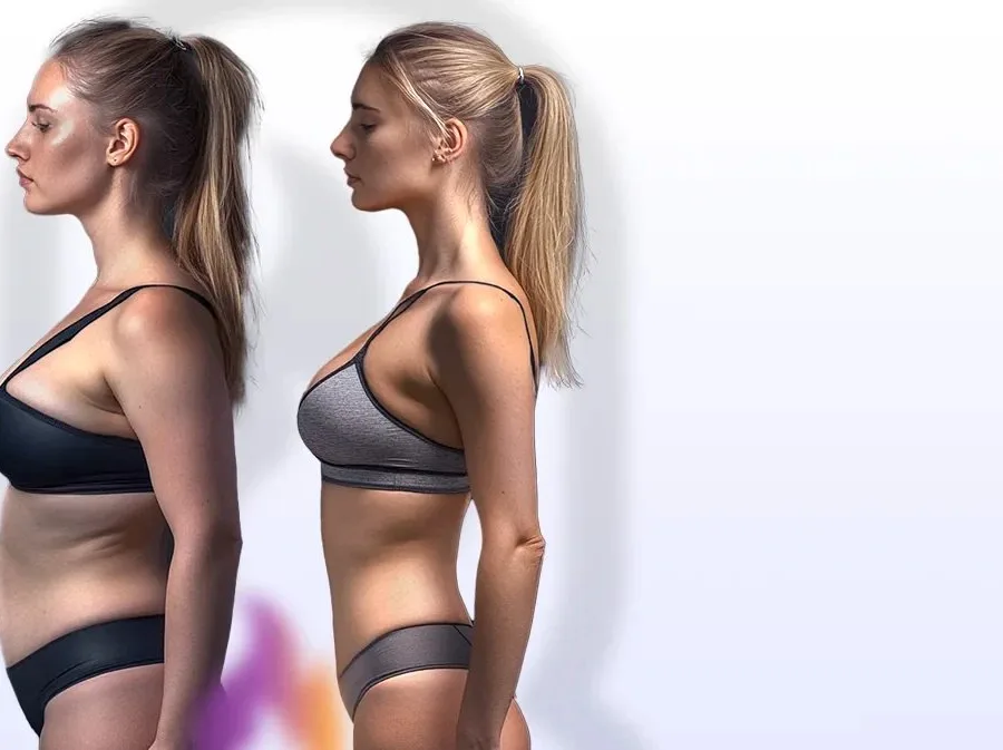 A mesma mulher de perfil: antes com estômago alto, depois com abdômen reto